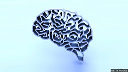 Artificial Intelligence may diagnose dementia in a day 人工智能或能在一日内诊断出失智症