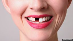 Tooth grown in laboratory by scientists 科学家在实验室里培育出牙齿