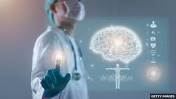 Huntington's disease successfully treated for first time 针对亨廷顿病的疗法首次取得成功