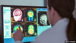 New study shows four pivotal ages for your brain 新研究揭示人类大脑的四个关键年龄点