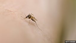 Why some people are mosquito magnets 为什么有的人更容易招蚊子咬