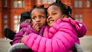 Conjoined twins given days to live are proving world wrong - BBC News