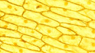 Microscope view of plant cells.