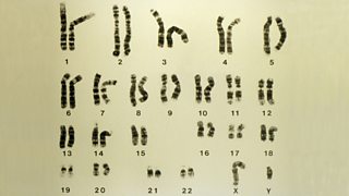Image of a light micrograph showing a set of healthy male chromosomes