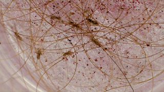 Michael Mosley - Infested! Living with parasites - BBC Teach