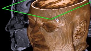 What is Cognitive Behavioural Therapy and how can it help?