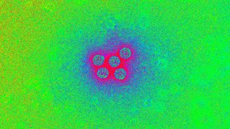 Contagious Cities
