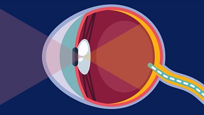 a diagram of an eye
