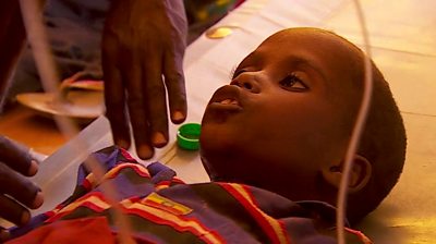Somalian boy is treated in hospital