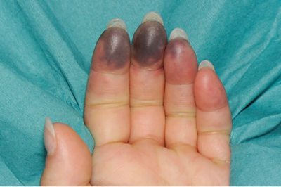 Heather Duncan's black fingers