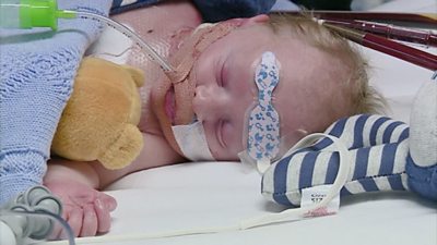 A candlelit vigil is held for baby Carter Cookson, who desperately needs a new heart.