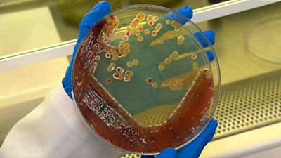 A scientist holds some bacteria in a petri dish
