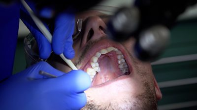 Dental procedure