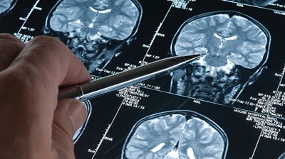 Pen pointing at scans of a brain
