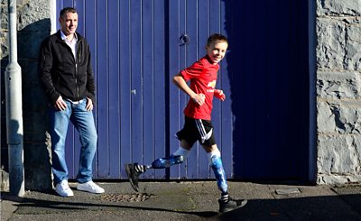 A boy who was not allowed to use a trampoline because he has prosthetic legs has received a £2,500 settlement in a disability discrimination case.