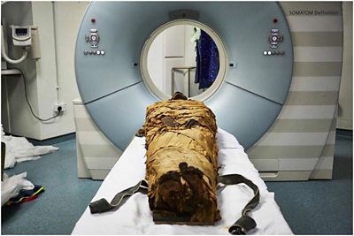 The mummified remains of Nesyamun being scanned in a hospital in Leeds