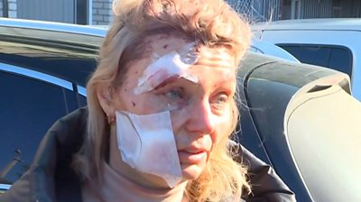 Injured woman in Ukraine