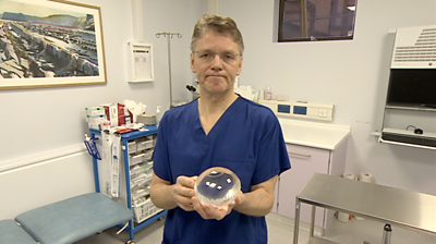 Somerset patients try new weight-loss gastric balloon pill