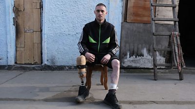 One of the Virovkin brothers who survived a mine explosion in southern Ukraine (Photo credit: NikVesti)