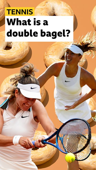 What are double bagels, and how common are they?