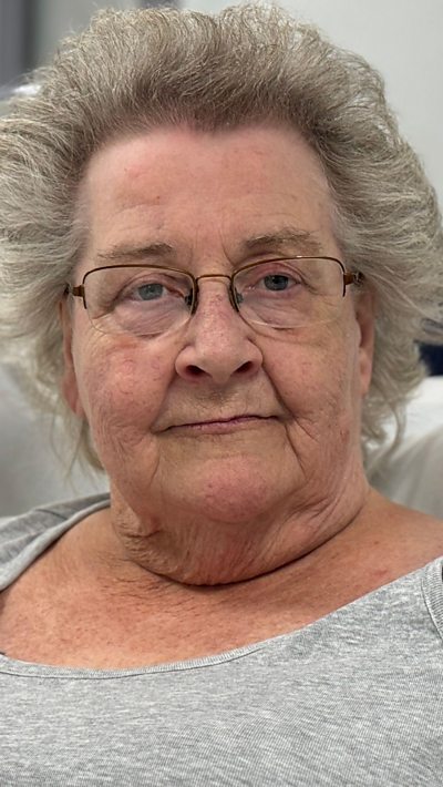 A woman with grey hair and glasses and a grey top in a bed in a hospital corridor