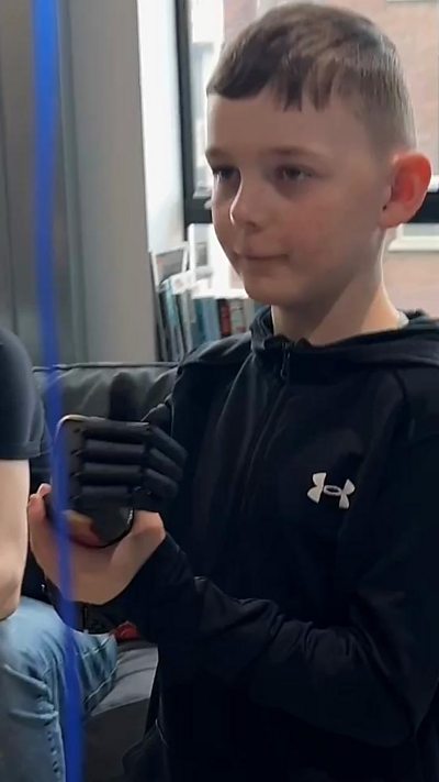 A young boy with brown hair, wearing a dark hoodie, holds his new black bionic arm with his other arm.
