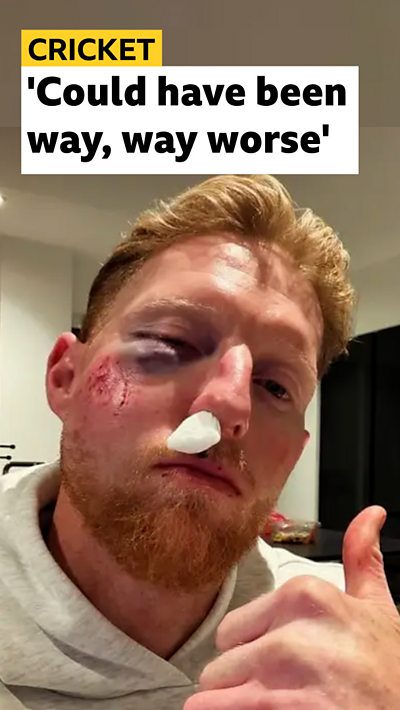 Ben Stokes with a black eye