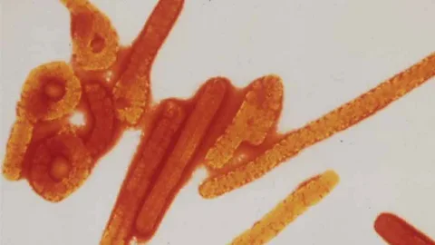 Witness History, Witness History, The Ebola virus