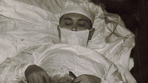 BBC World Service - Witness History, The Man Who Removed His Own Appendix