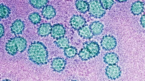 Witness History, Witness History, The Creation of the Cervical Cancer Vaccine