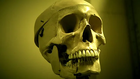 A skull