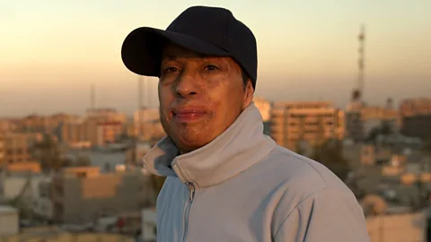 The Documentary Podcast, Amar: Alone in the world