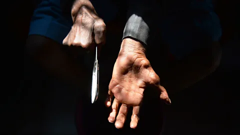 The Documentary Podcast, Living with leprosy