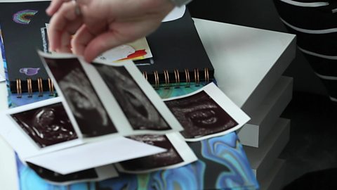 A mum's hand holding her scan picture.