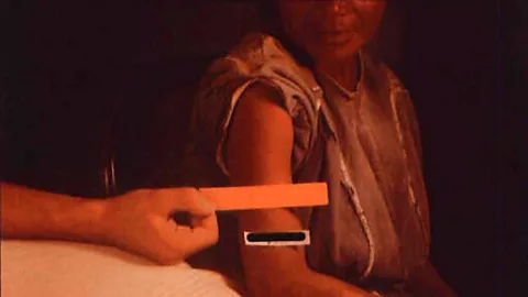 Witness History, Witness History, The Guatemalan syphilis scandal