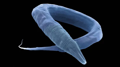 Witness History, Witness History, How a worm helped explain human development