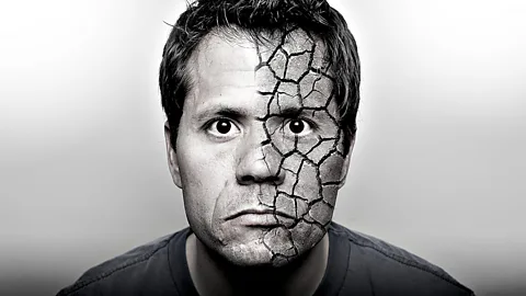 CrowdScience, CrowdScience, Why is human skin so rubbish?