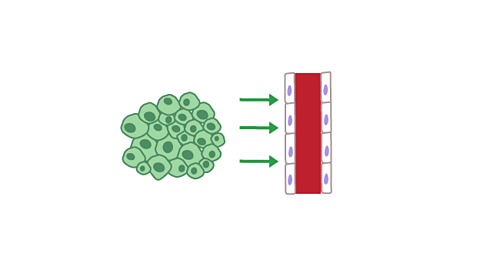 A tumour secretes chemicals to nearby blood vessels