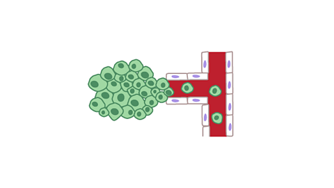 Cancer cells detach from the tumour and are transported through the blood vessels