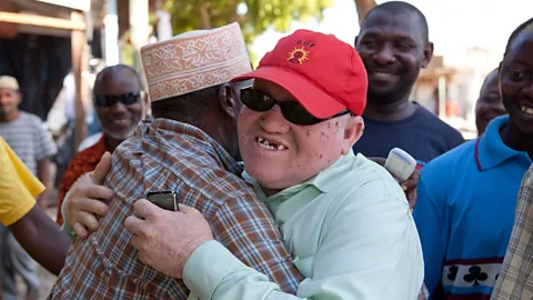 Witness History, Witness History, Tanzania's first elected albino MP