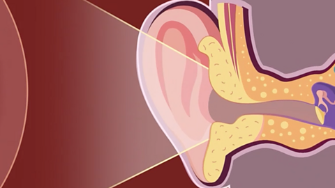 Diagram of the outer ear with sound waves reaching it.