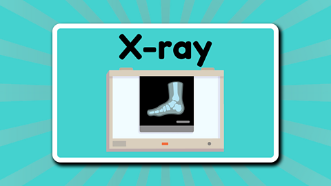 An X-ray image of a foot