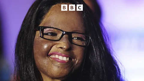 Witness History, Witness History, Surviving an acid attack and changing the law
