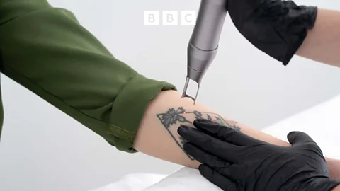 Business Daily, Business Daily, The growth of tattoo removal