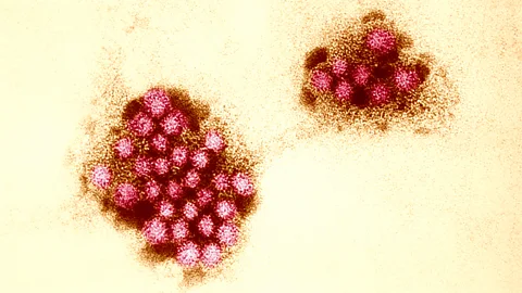 Norovirus particles viewed under a microscope (Credit: Getty Images)