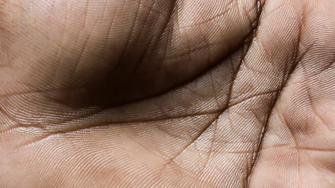 A close up of skin on a human hand (Credit: Getty Images)