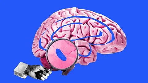 An illustration showing the locus coeruleus's location in the brain (Credit: Serenity Strull/BBC/Getty Images)