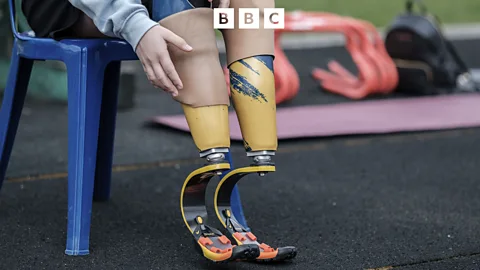 Sporting Witness, Sporting Witness, Why I designed the prosthetic running leg