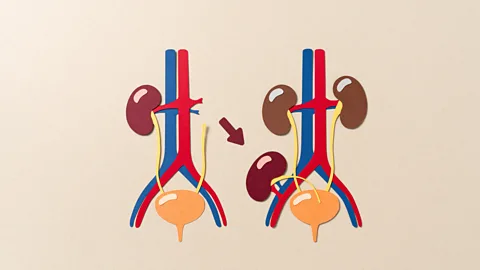 Health Check, Health Check, The Kidney Waiting Game