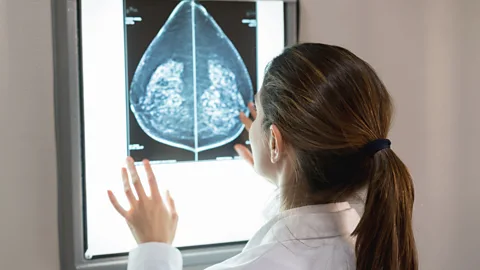 Health Check, Health Check, A new way to screen for cancer in dense breasts